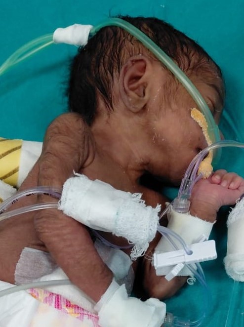 Baby of Sitaram Ulsha Kolhe, 9 Days Old